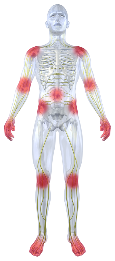 National Headquarters Common Pain Areas